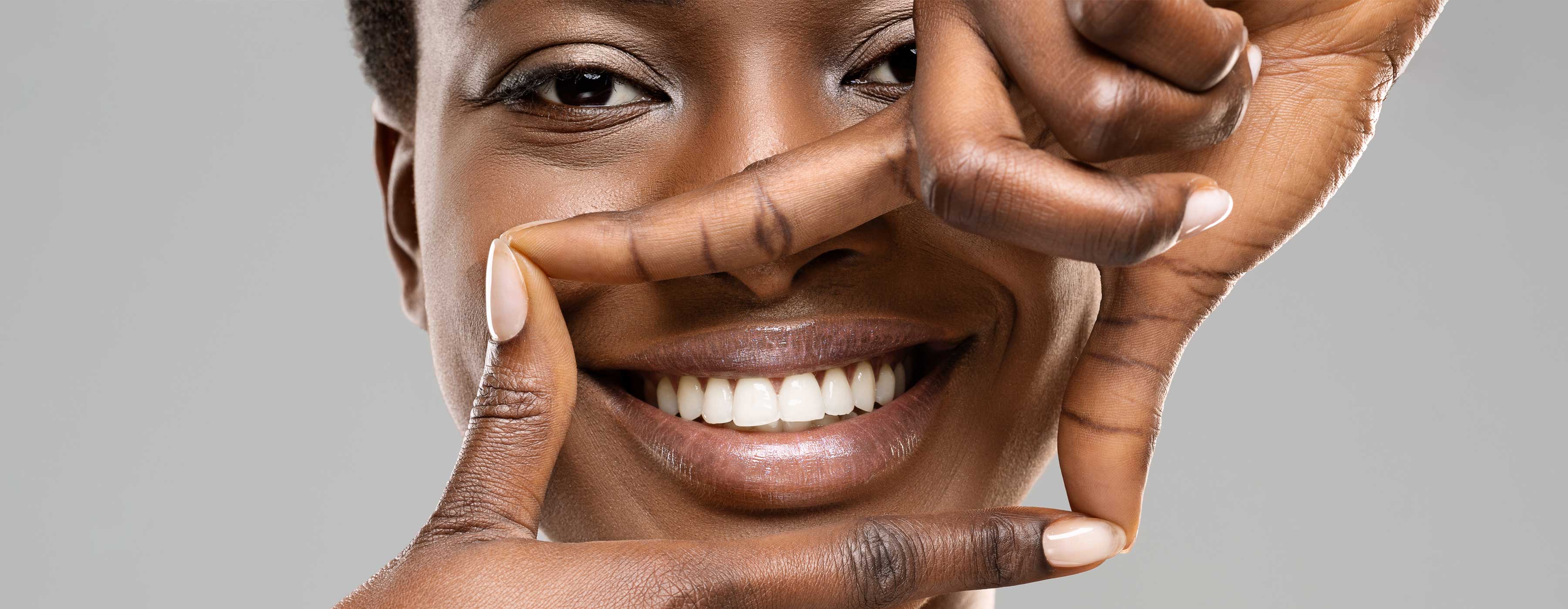 Planejamento Estético Digital. Foto de mulher emoldurando seu sorriso com dentes brancos com dedos das duas palmas da mão.