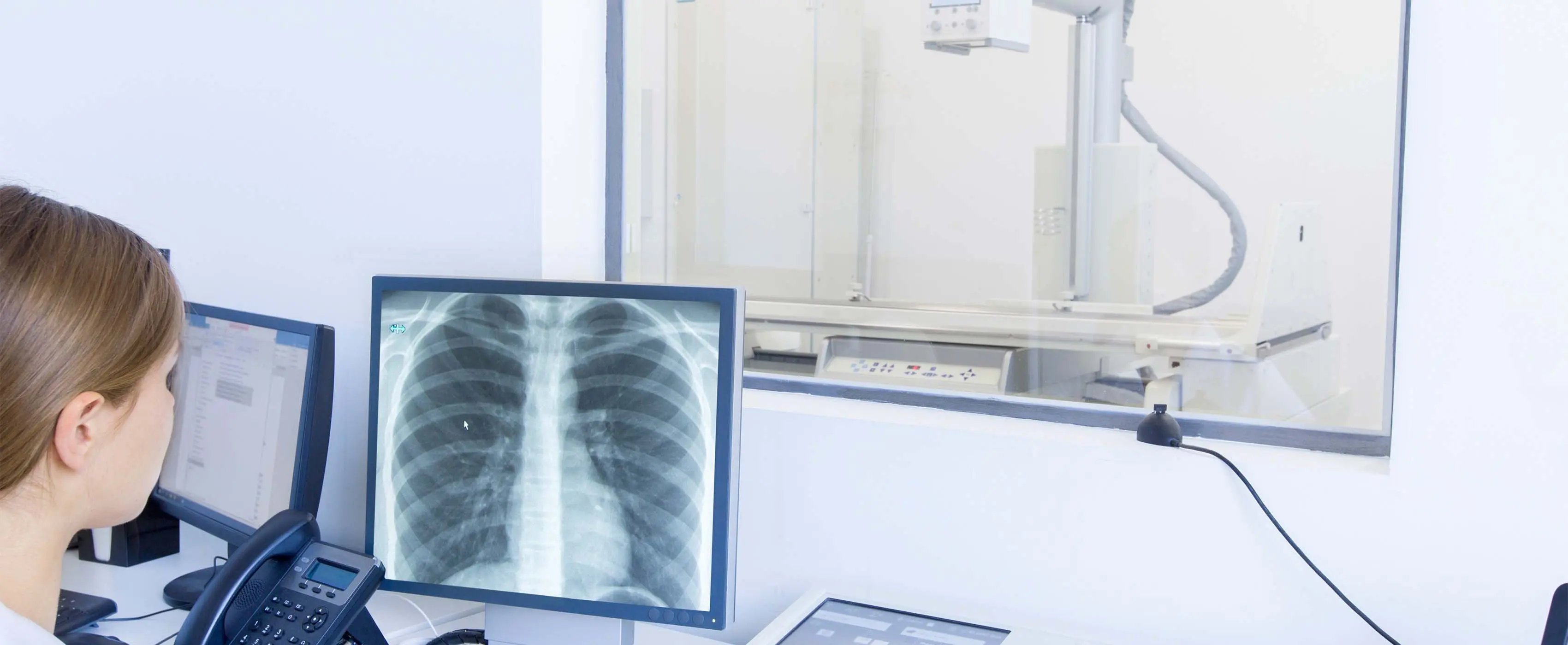 Foto de uma tela de computador com uma imagem de raio x em ambiente hospitalar, com equipamentos ao fundo.