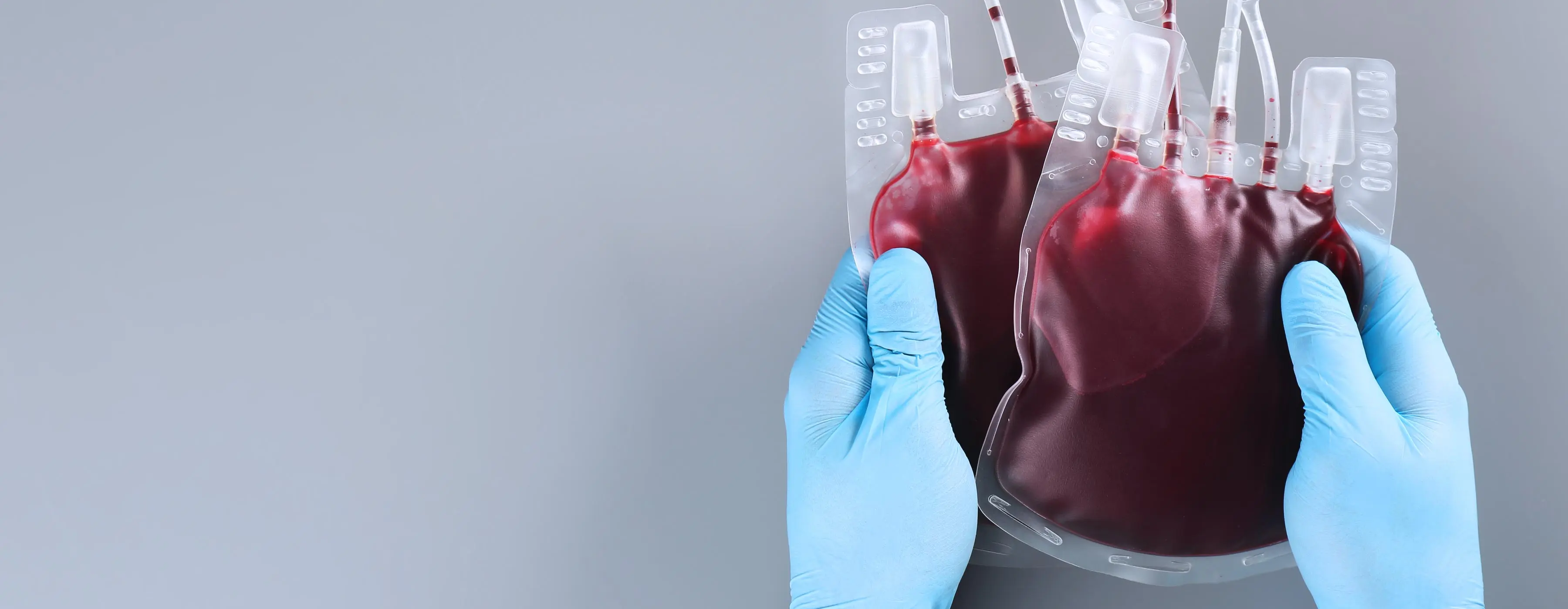 Foto de uma pessoa com luvas cirúrgicas segurando bolsa de sangue com as duas mãos.