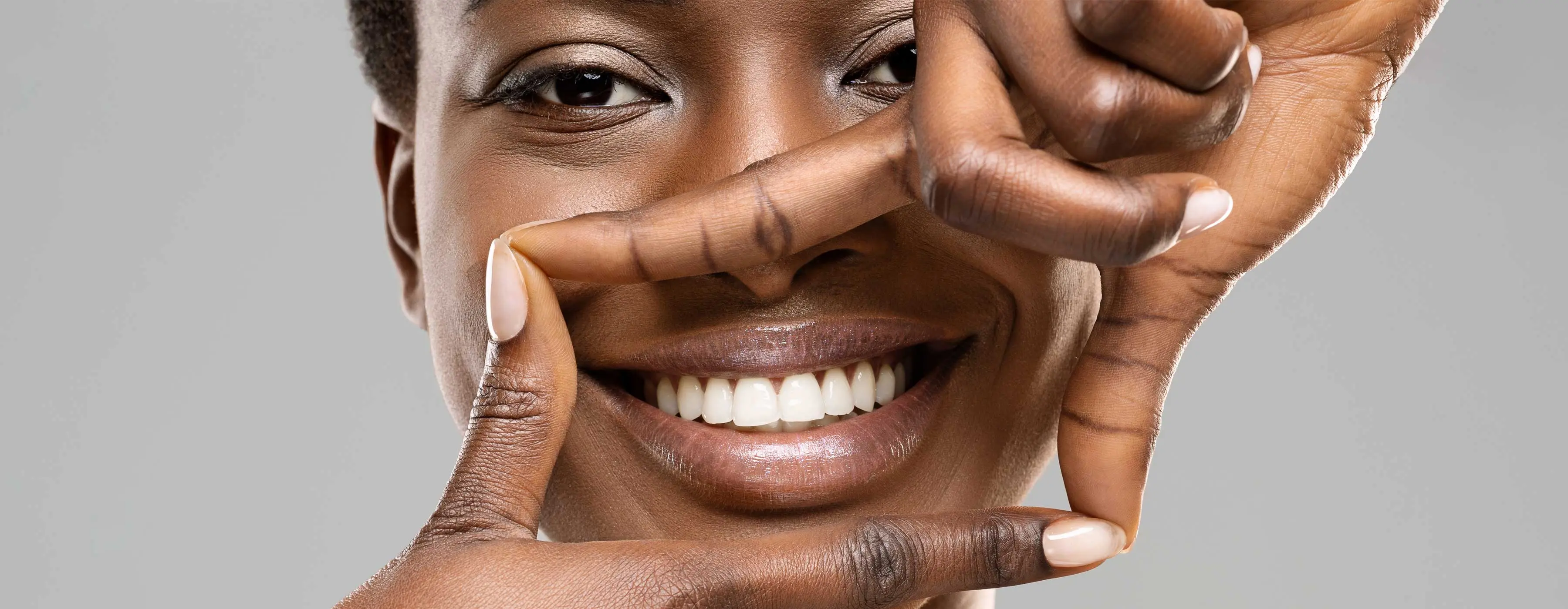Foto de mulher emoldurando seu sorriso com dentes brancos com dedos das duas palmas da mão.