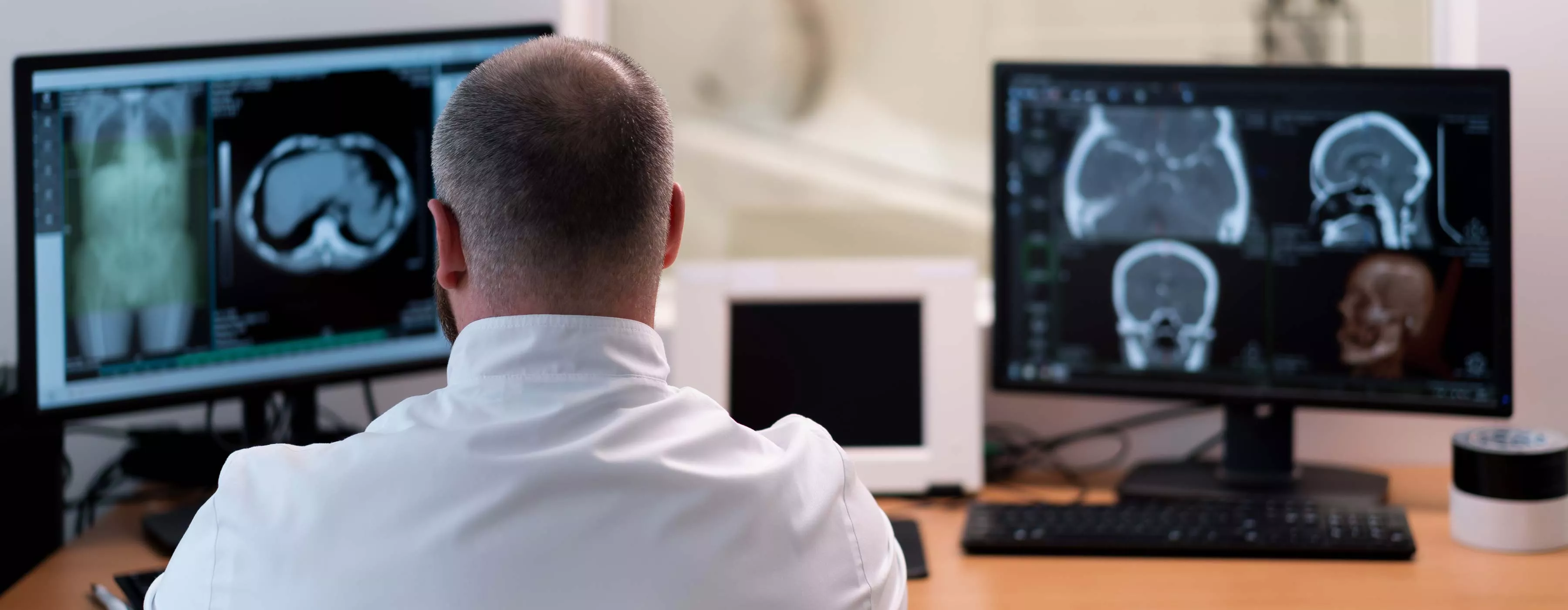 Foto de um homem de costas usando um jaleco, analisando dois monitores que exibem tomografias da barriga e da cabeça
