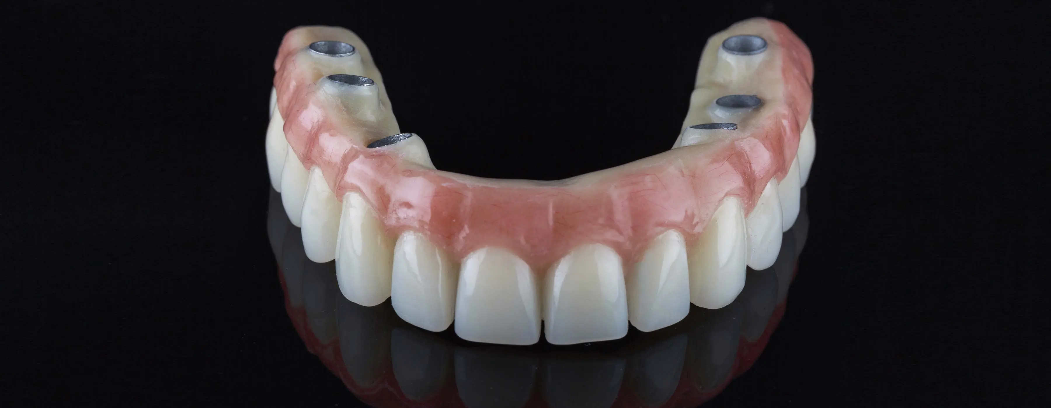 Foto em close de uma prótese dentária