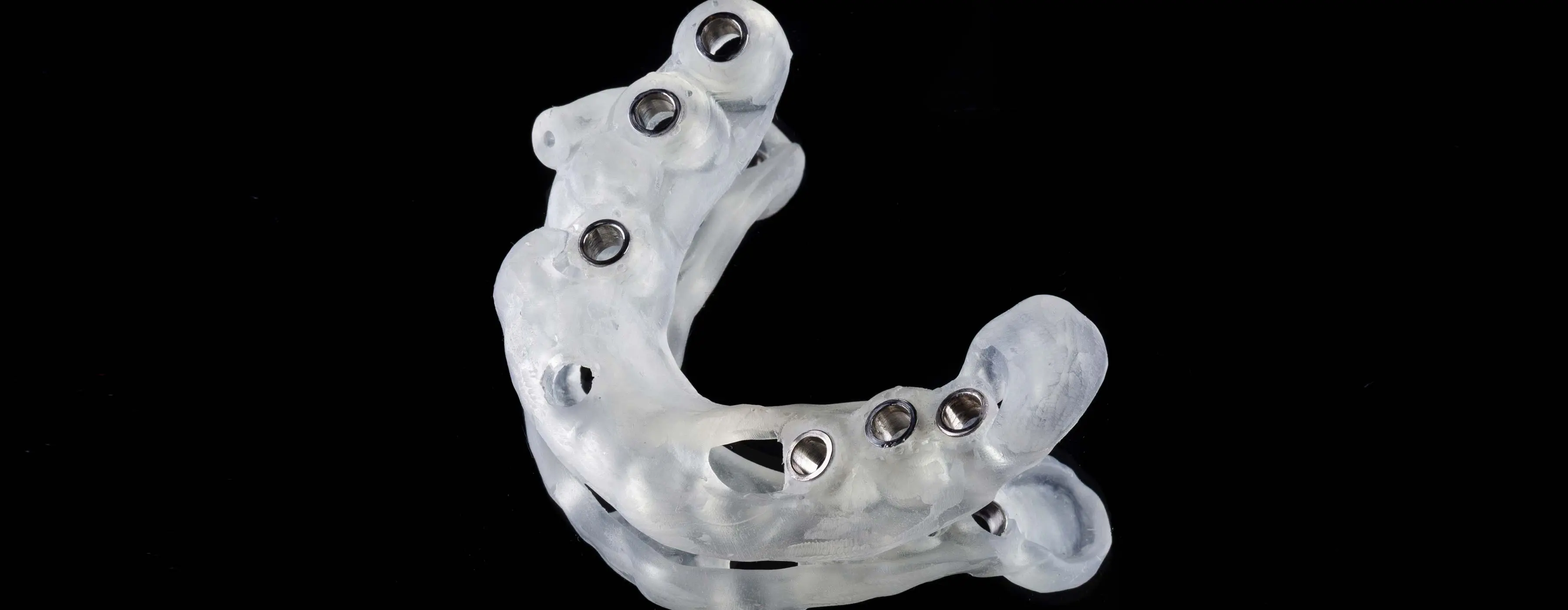 Foto em close de uma prótese dentária