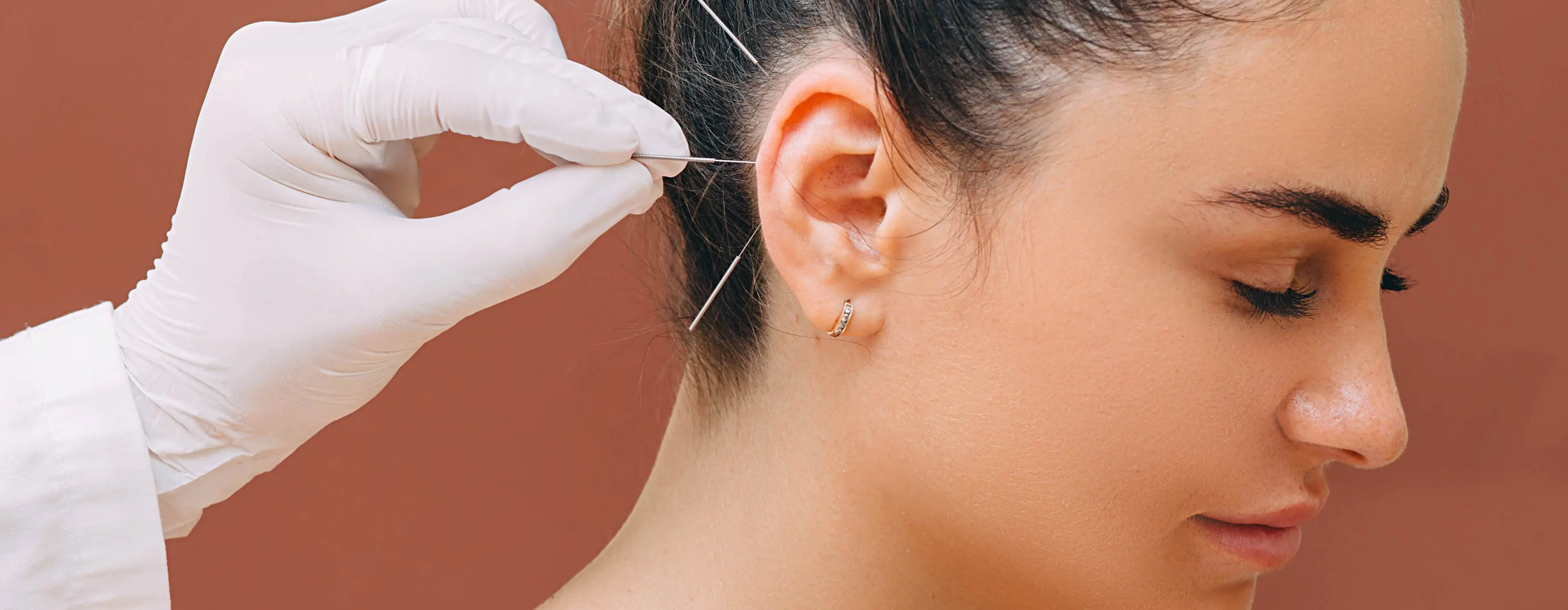 Foto em close do rosto de uma mulher recebendo tratamento de auriculoterapia na orelha.