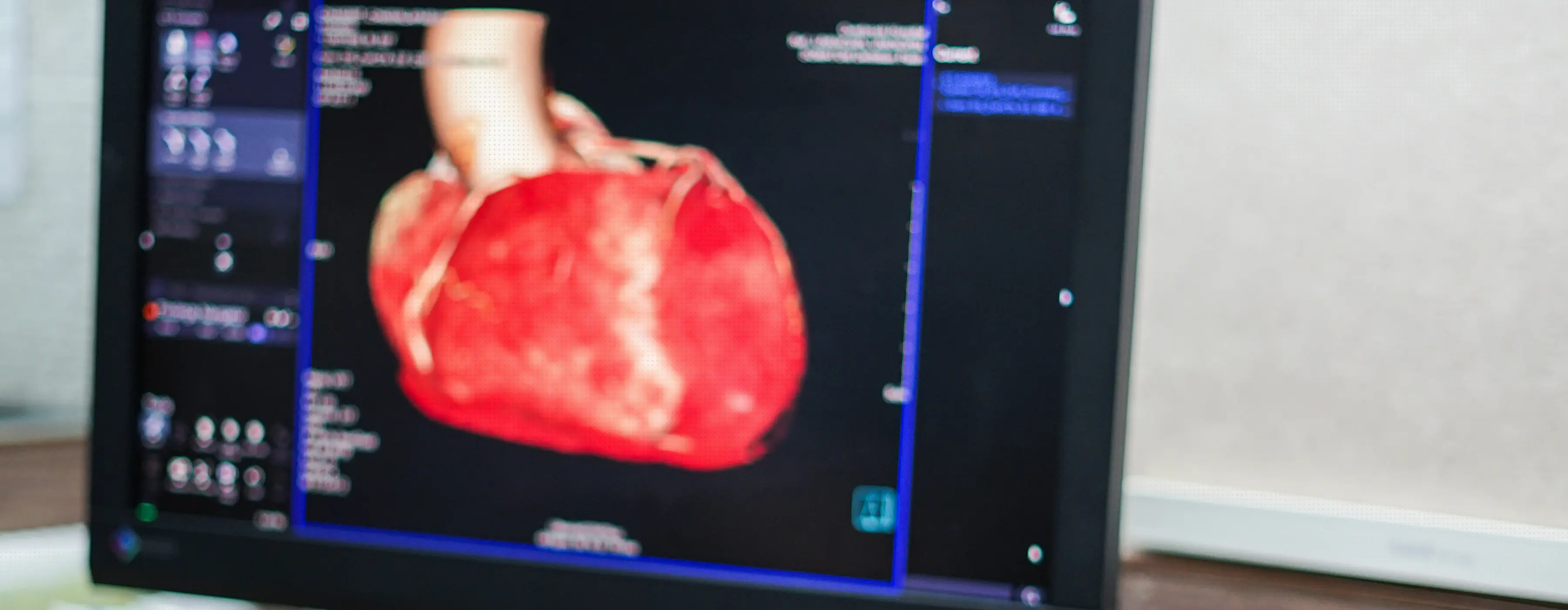 Foto em close de tela com imagem de tomografia computadorizada de um coração.