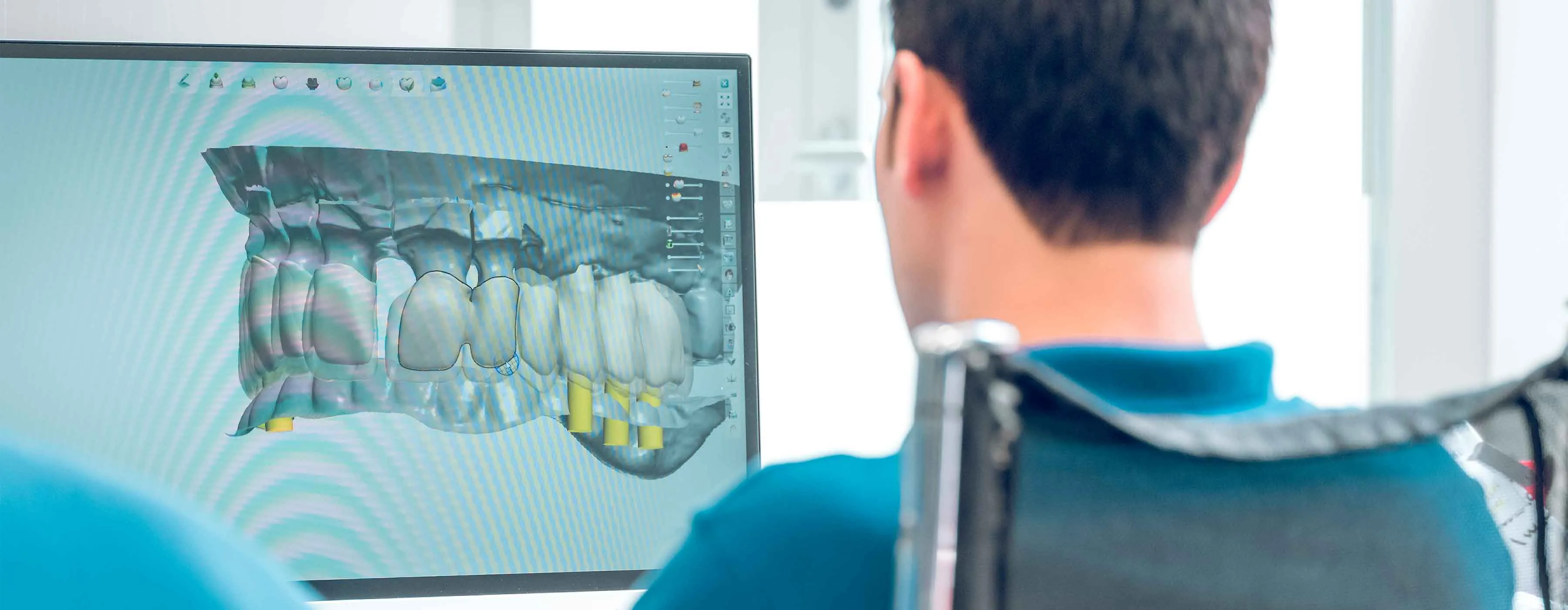 Dentista observa tela de computador exibindo dentes criados em 3D.