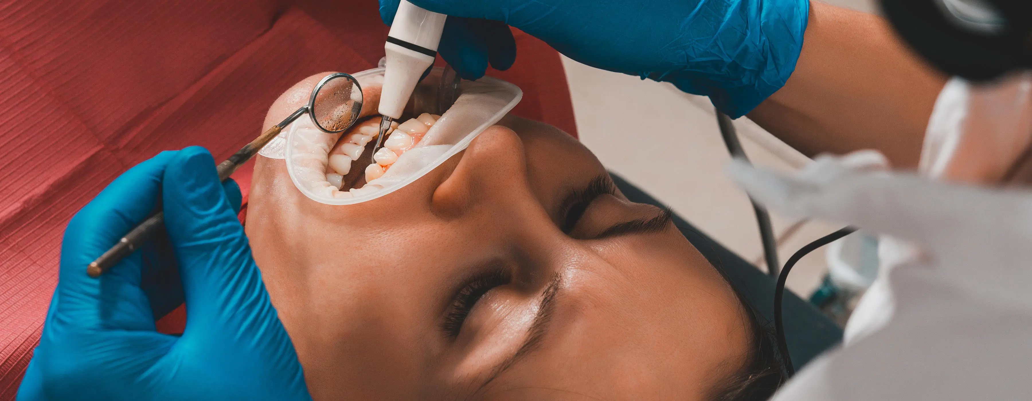 Foto em close de boca de paciente que está sendo analisada por um dentista em consultório.