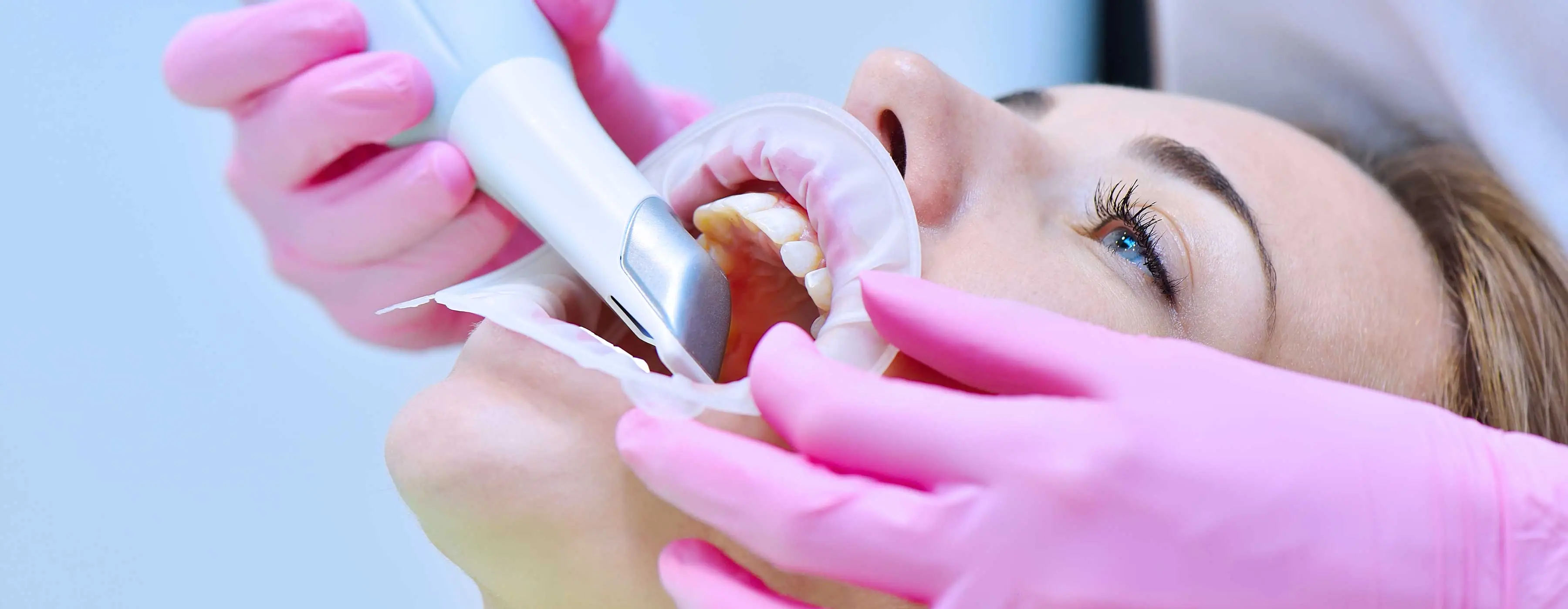 Foto com foco nas mãos de um profissional utilizando escanner nos dentes inferiores de uma mulher.
