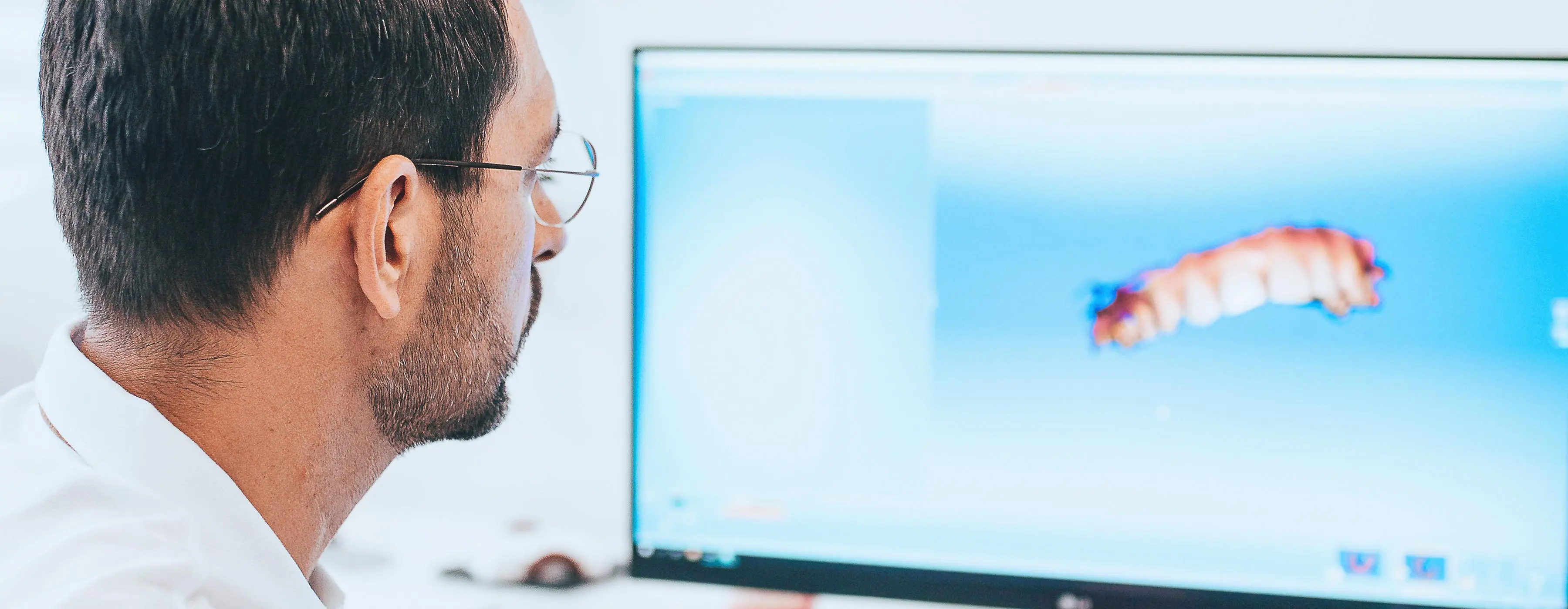 Foto em close de homem de costas, vendo uma prótese dentária em 3D em um monitor.