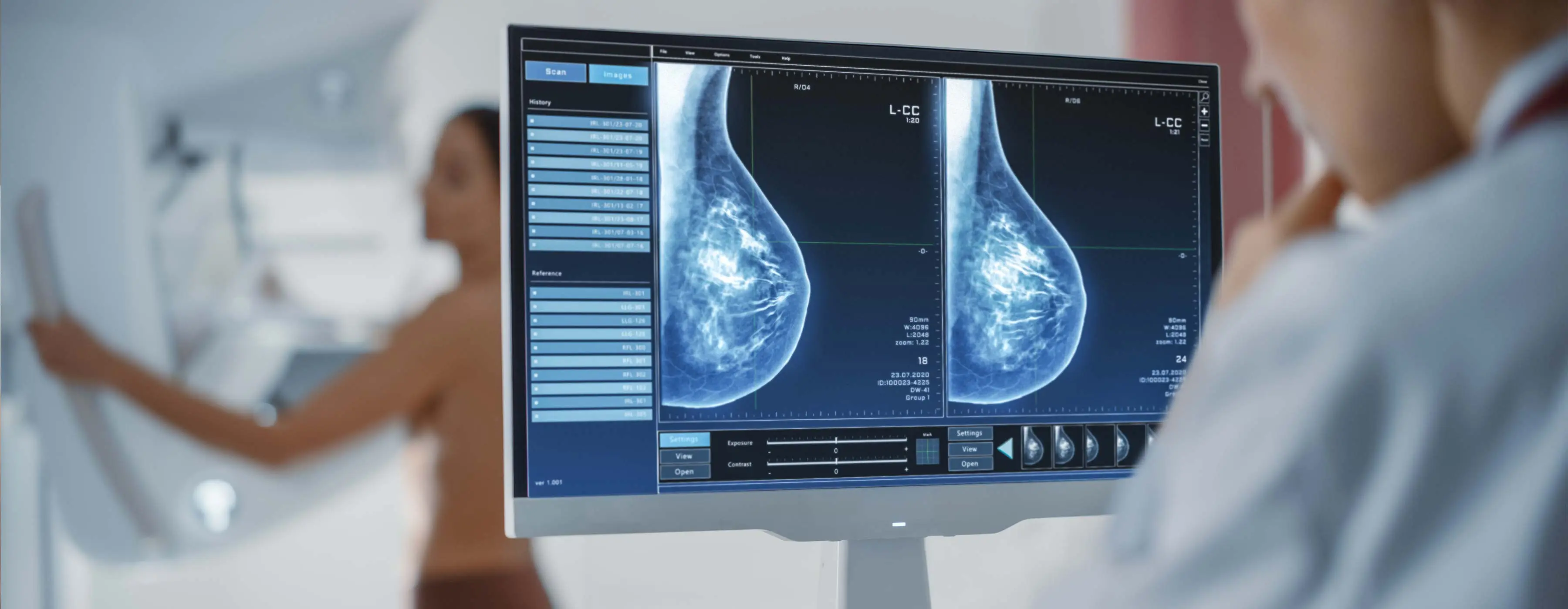 Foto de  pessoa analisa monitor com imagens de mamografia, com uma mulher ao fundo realizando exame de mama