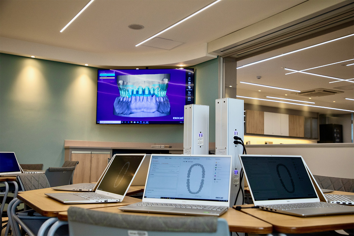 Foto de destaque a computadores e uma televisão com imagem de arcada dentária em 3D.