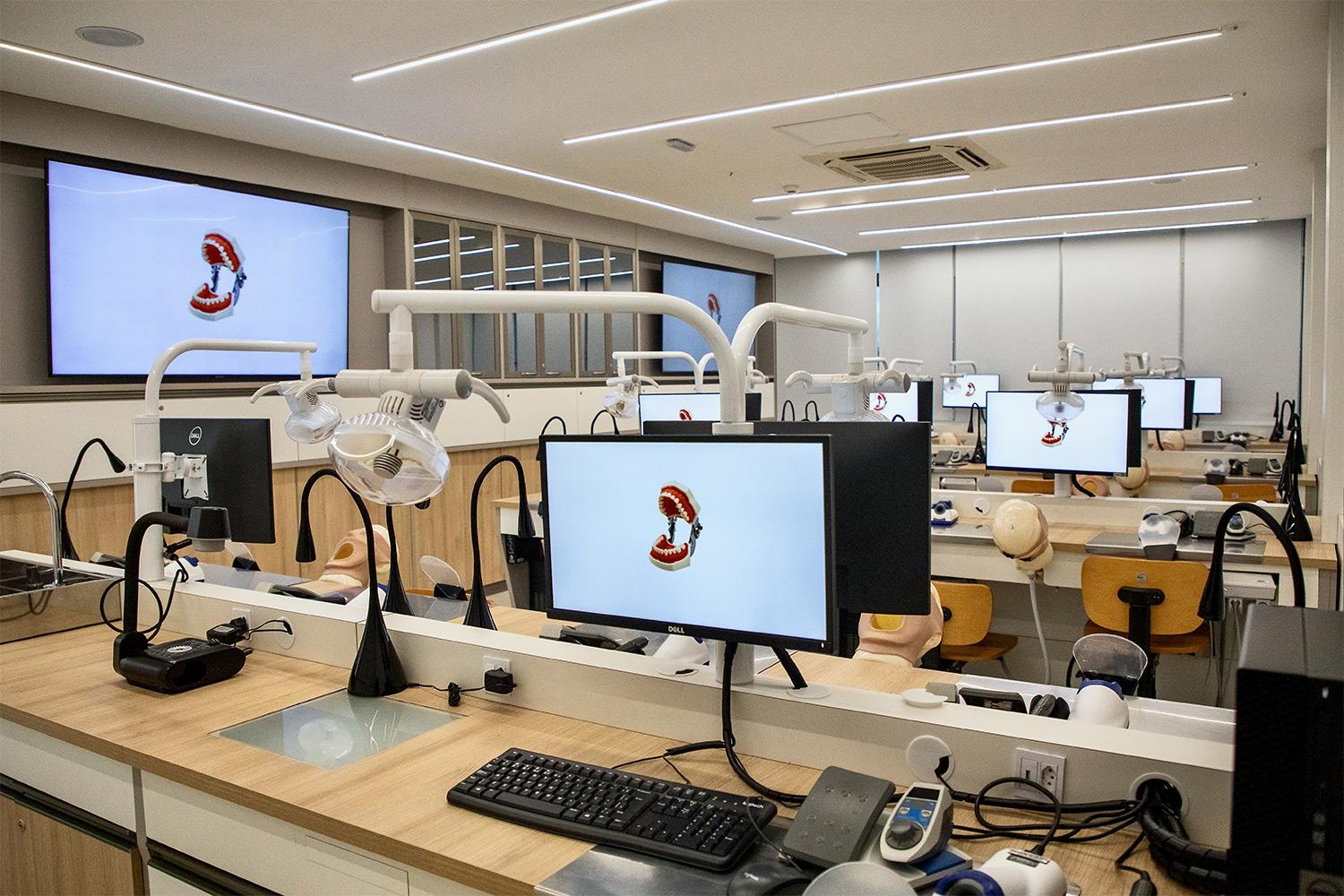 Foto de monitores com imagens digitais de arcadas dentárias.