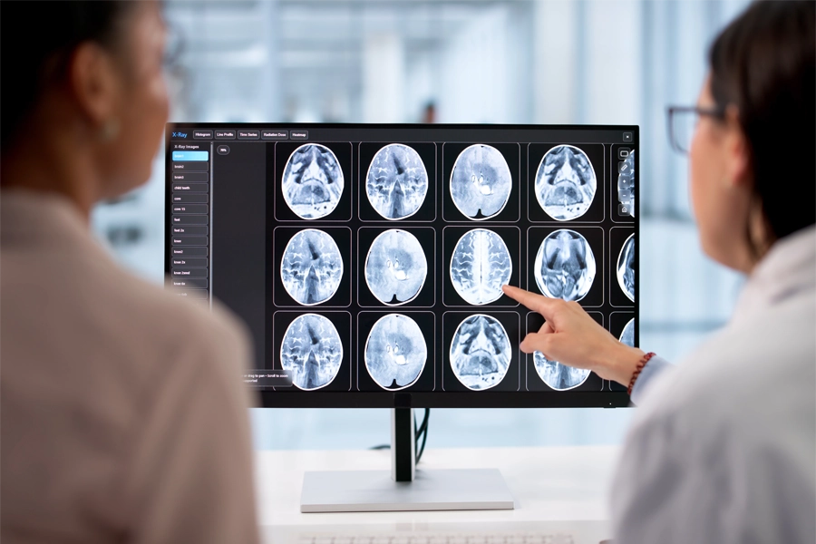 Imagem: duas profissionais de radiologia estão sentadas de frente para a tela de um computador analisando imagens de raio-x da cabeça de um paciente.