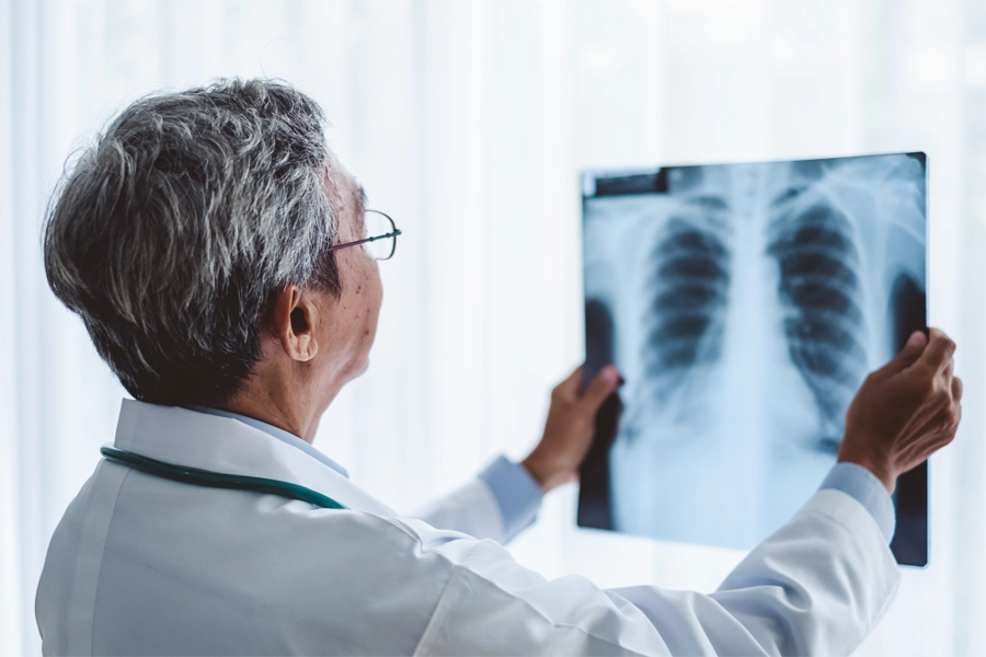 Imagem: profissional de radiologia segura nas mãos, contraluz, a chapa de raio-x do tórax de um paciente enquanto analisa os resultados do exame.