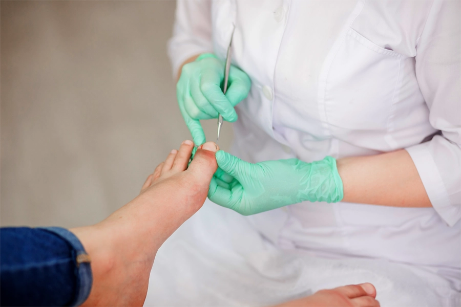 Imagem: podóloga usa ferramenta de aço para fazer a limpeza das unhas do pé de paciente.